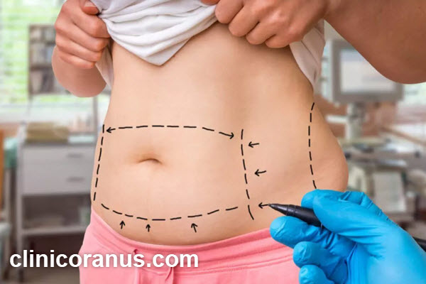 ویژگی های بهترین جراح پیکرتراشی در تهران